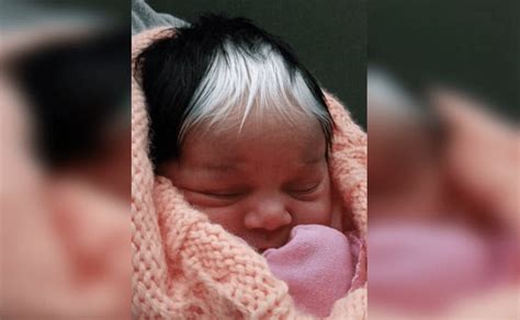 Upbeat News This Baby Was Born With White Hair And Doctors Had No Idea Why