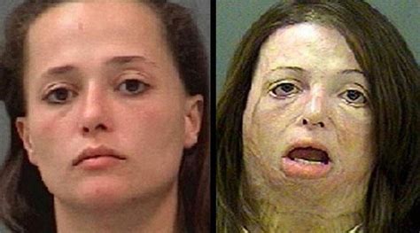 Shocking These Images Will Make Sure You Never Ever Use Meth