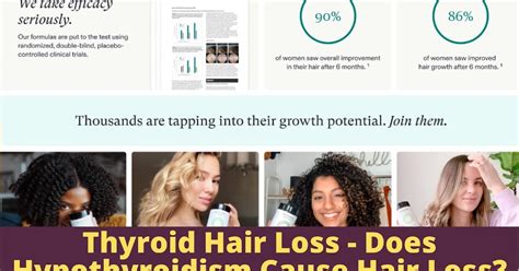 Thyroid Hair Loss Does Hypothyroidism Cause Hair Loss Dgs Health