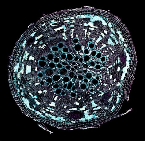 Microscopic Cross Section Cut Of A Plant Stem Under The Microscope