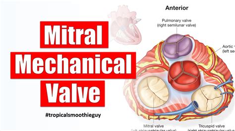 How Heart Valve Replacement Works Through Mitral Mechanical Valve