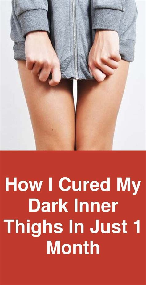 how i cured my dark inner thighs in just 1 month first let me tell you causes behind dark inner
