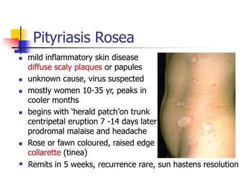 Ppt Non Infectious Skin Diseases Powerpoint Presentation Free