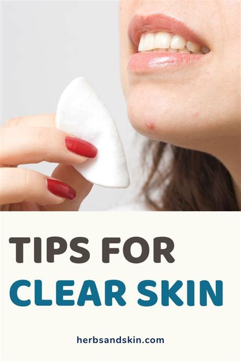 Tips For Clear Skin Clear Skin Tips Clear Skin Remedies Skin Tags
