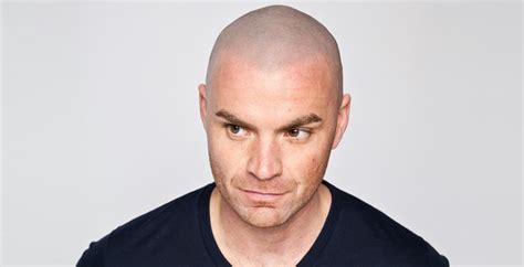 This is where it shines as a hair loss treatment. Combat Hair Loss on Men with Scalp Micropigmentation | Skalp®