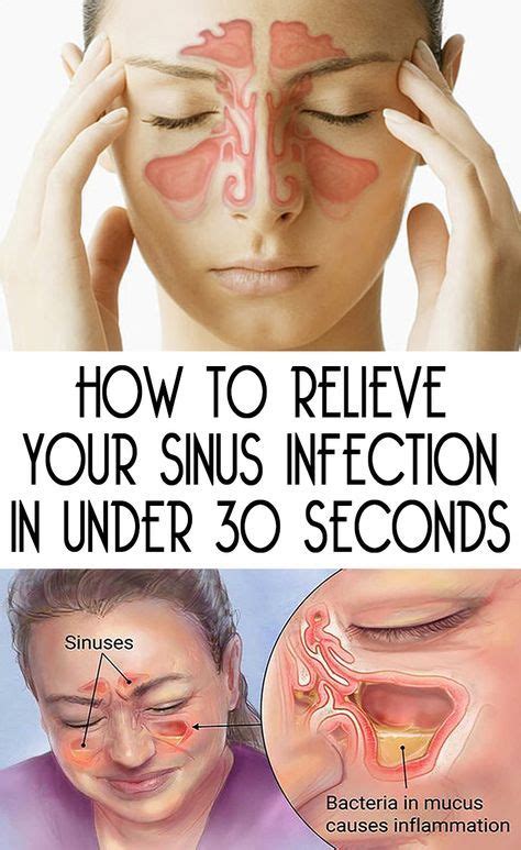 Heres How To Clear Your Sinuses Quickly In Just Two Steps Healthy Deadline