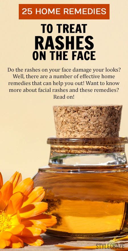 21 Home Remedies To Get Rid Of Rashes On The Face Diet And Prevention