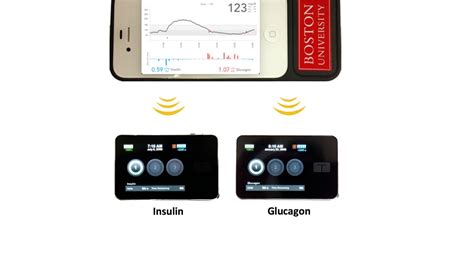 Bionic Pancreas Manages Diabetes For You