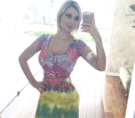 Model And Miss Bumbum Runner Up Nearly Died After Plastic Injections Led To Gaping Holes In