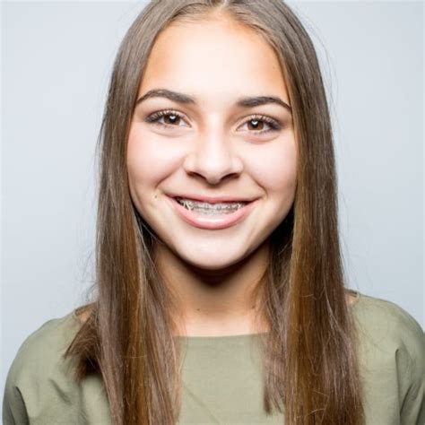 Our Patients Beautiful Smiles Nudera Orthodontics In South Elgin Il