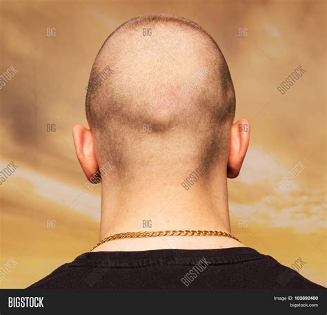 Adult Man Bald Head Image And Photo Free Trial Bigstock