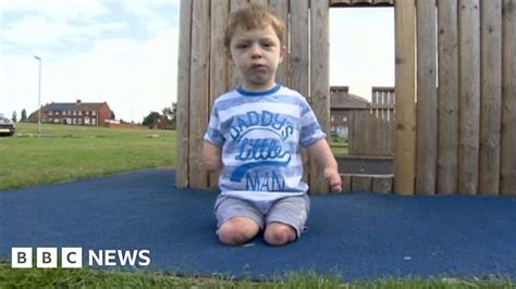 Plea From Mum Of Boy Who Lost Limbs To Meningitis B Bbc News