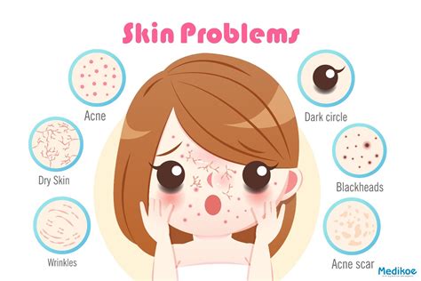 Skin Problems Guide To Contagious Rashes Richmond Hill Cosmetic Clinic