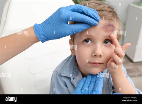 Doctor Checking Boys Forehead With Bruise At Hospital Closeup Stock