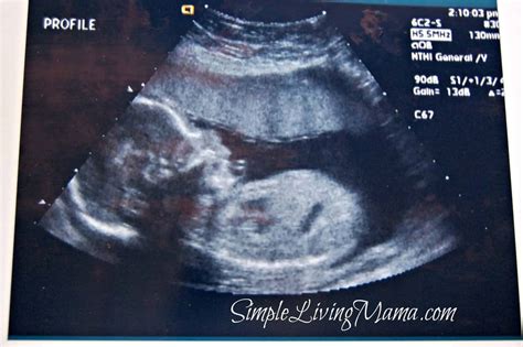 week ultrasound simple living mama