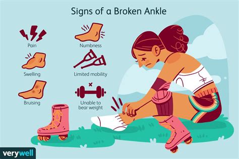 Broken Ankle Symptoms And Treatment