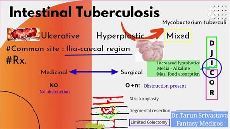 Intestinal Tuberculosis Symptomsdiagnosisinvestigationtreatment In