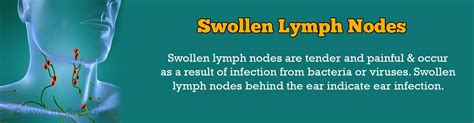 Swollen Lymph Nodes Symptoms