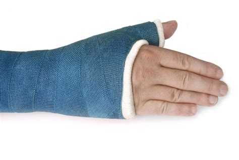 Waterproof Fracture Casts Melbourne Hand Therapy