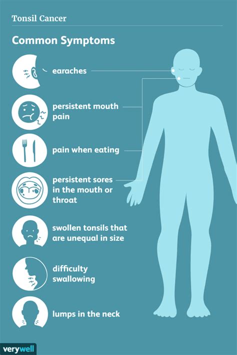 Tonsil Cancer Symptoms Causes And Treatments