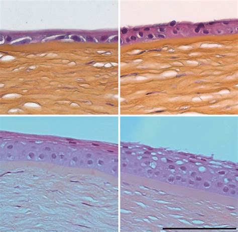 Cross Sections Of Corneal Epithelium And Anterior Stroma And Days