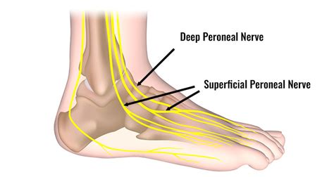 Peroneal Nerve Injury Symptoms Causes Treatment And Exercises