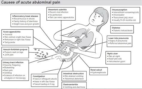 Left Lower Abdominal Pain Differential Diagnosis