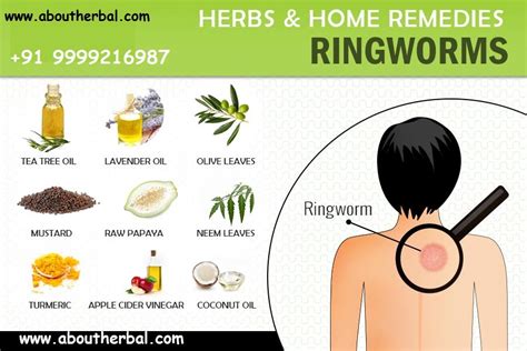 Astonishing Home Remedies For Ringworm Treatment How To Get Free Of