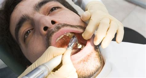 Wisdom Tooth Infections And Ear Infections
