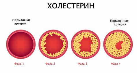 Повышен холестерин какая нужна диета Холестерин, правила подготовки к сдаче анализа, расшифровка результатов Холестерин, правила подготовки к сдаче анализа, расшифровка результатов Повышен холестерин какая нужна диета