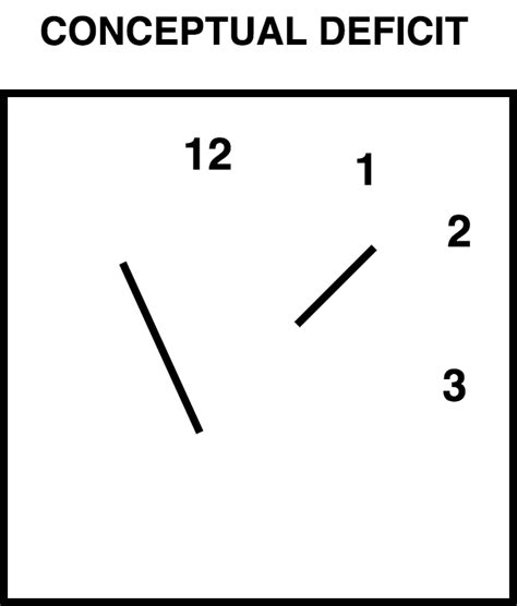 Moca scoring nuances with clock draw : Clock-Drawing Test (CDT) - PsychDB