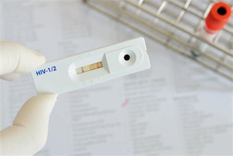 What Is An ELISA HIV Test With Pictures