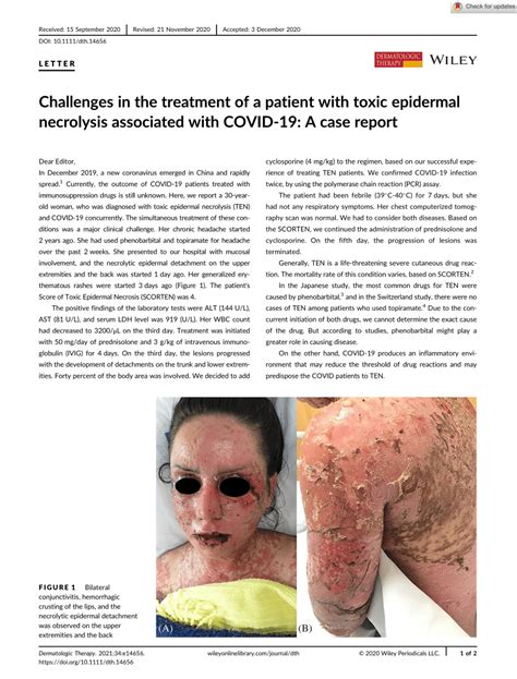 Pdf Challenges In The Treatment Of A Patient With Toxic Epidermal