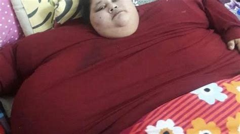 La mujer más obesa del mundo pierde kg tras operación en India El Nuevo Herald