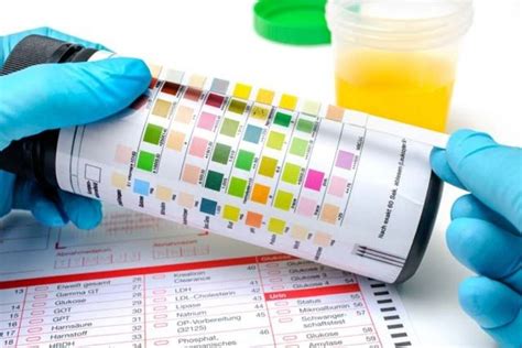 Tiras reagentes para análise urinária o que você precisa saber Indavidas Blog