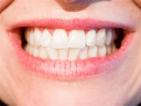 Ways To Keep Your Teeth Healthy And White For Life Get That Right