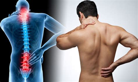 Back Pain Definition Acute Or Short Term Low Back Pain Generally Lasts