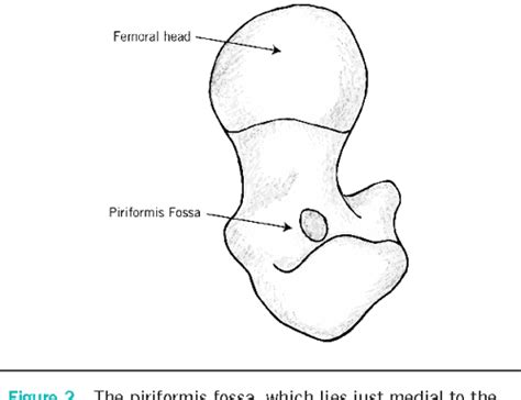 Figure 1 From Piriformis Fossa Approach In Optimising Femoral Neck