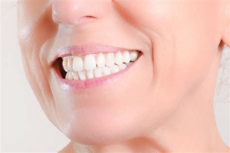 The Easy Guide To Understanding Mini Dental Implants