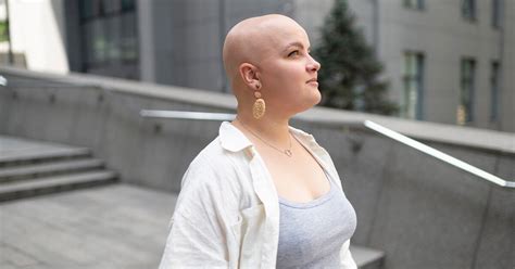 FDA Approves New Drug For Alopecia Areata