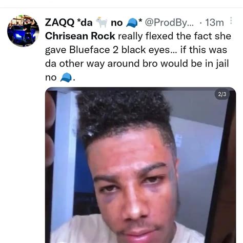 Chrisean Rock Shows Off Black Eye She Allegedly Gave Rapper Blueface