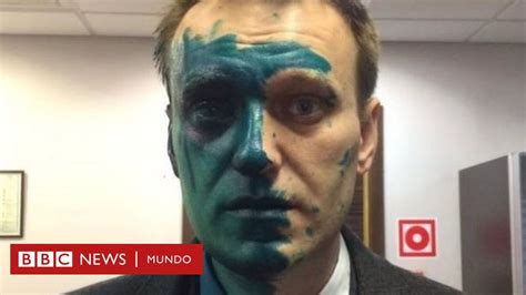 Quién es Alexei Navalny el mayor crítico de Putin en Rusia y que está