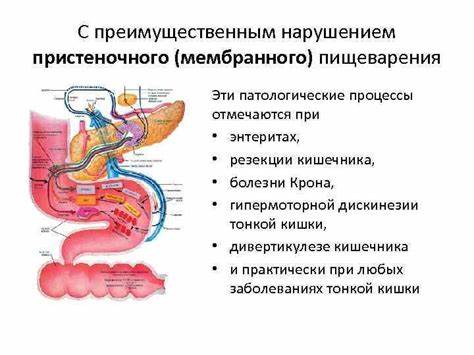 Синдром мальдигестии диета ОСНОВНЫЕ СИНДРОМЫ ПРИ ЗАБОЛЕВАНИЯХ КИШЕЧНИКА Основные синдромы ОСНОВНЫЕ СИНДРОМЫ ПРИ ЗАБОЛЕВАНИЯХ КИШЕЧНИКА Основные синдромы Синдром мальдигестии диета