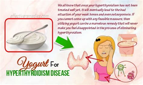 Top 28 Natural Home Remedies For Hyperthyroidism Disease