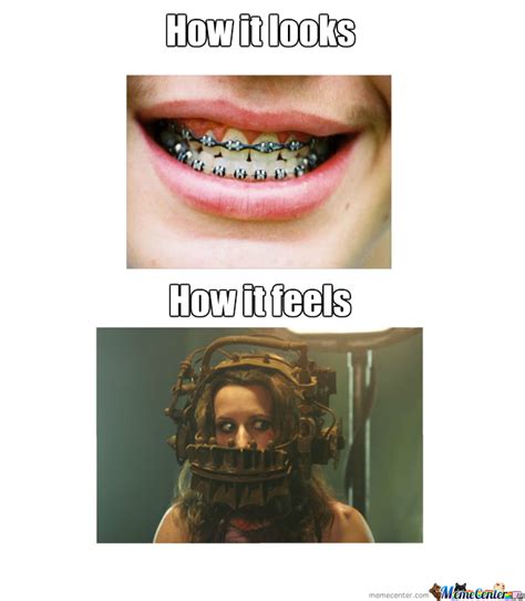 21 Funny Memes With Braces Factory Memes