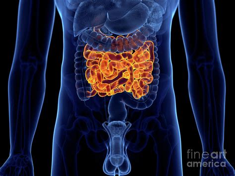 cancer of the small intestine 3 photograph by sebastian kaulitzki science photo library fine
