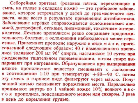 Пероральный дерматит диета примерное меню Себорейный Дерматит Диета Меню На Неделю – Telegraph Себорейный Дерматит Диета Меню На Неделю – Telegraph Пероральный дерматит диета примерное меню