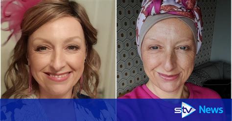 Woman Uses Life Savings To Fund Ovarian Cancer Surgery Due To Nhs Waiting Times Stv News