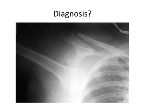 Shoulder Radiography