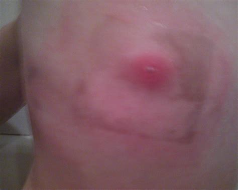 Red spider mites (tetranychus urticae) look like tiny red dots moving around the underside of plant leaves. Spider Bite Red